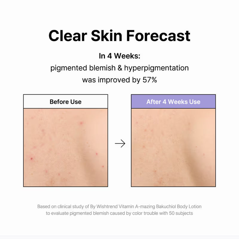 By Wishtrend Vitamin A-Mazing Bakuchiol Body Lotion (150g)