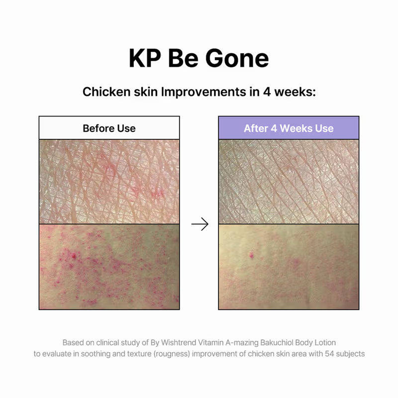 By Wishtrend Vitamin A-Mazing Bakuchiol Body Lotion (150g)