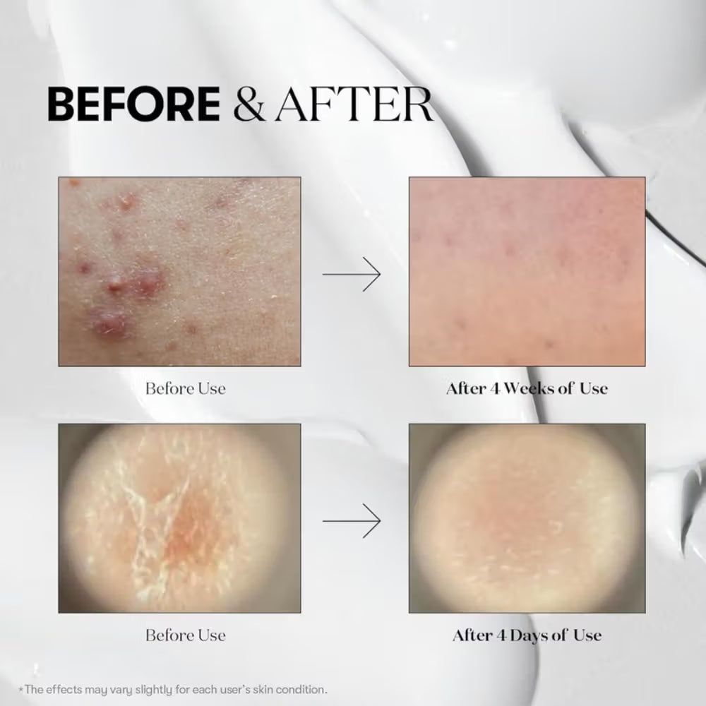 VT Cosmetics Reedle Shot 300 Stick 2ml x 10pcs