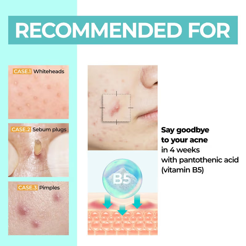 Numbuzin No.1 Pantothenic B5 Active Soothing Cream (80ml)