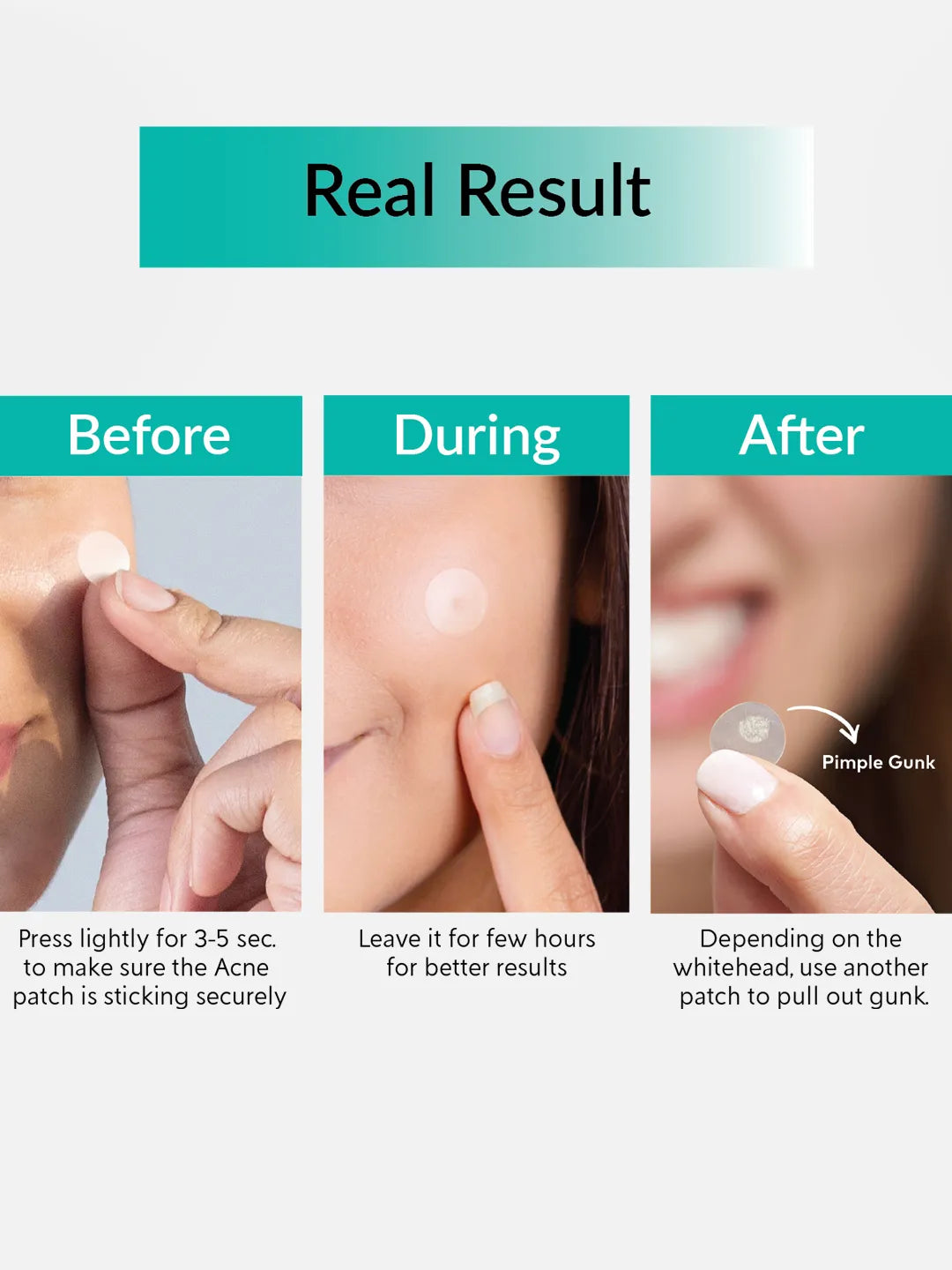 Priveda Seoul Spot Clearing Acne pimple patch (57 patches)  (20 g)