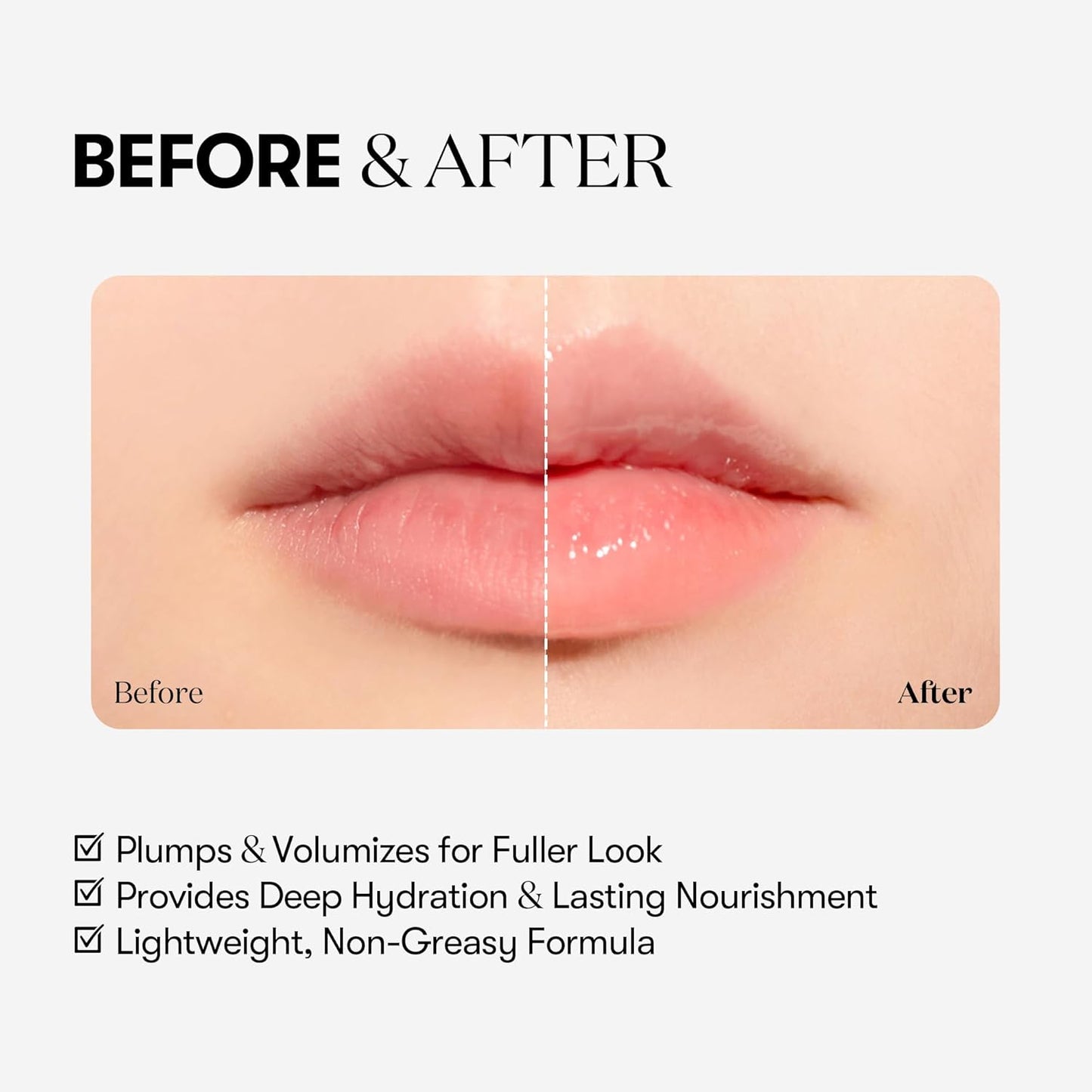 VTCOSMETICS Reedle Shot Lip Plumper, 0.15 oz (4.3 g), Moisturizing, Transparent, Lip Gloss, Fragrance-free, Korean Cosmetics (Beginner)