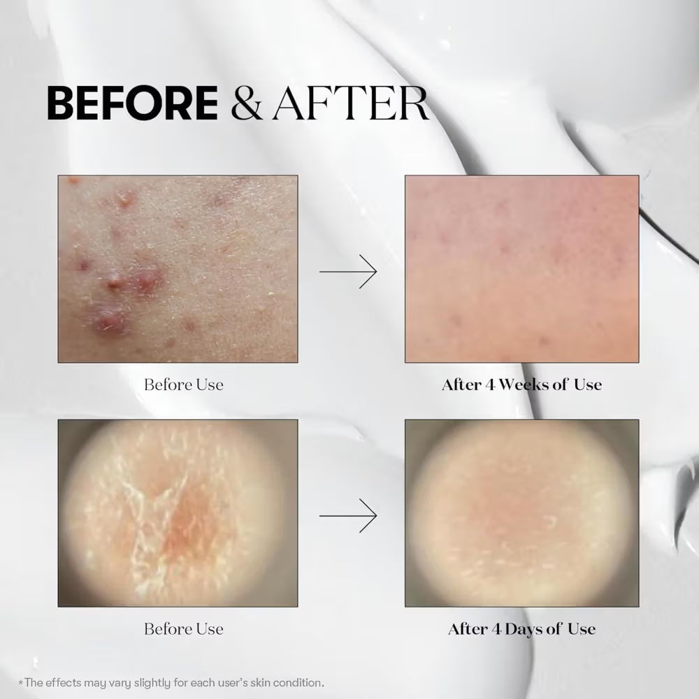 VT Cosmetics Reedle Shot 100 Stick 2ml x 10pcs