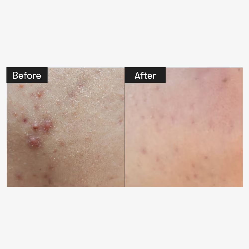 VT Cosmetics Reedle Shot 100 (50ml)